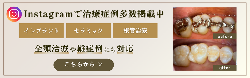 州デンタルクリニックInstagramバナー